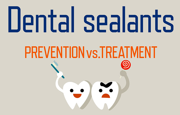 Dental Sealants - Prevention and Care