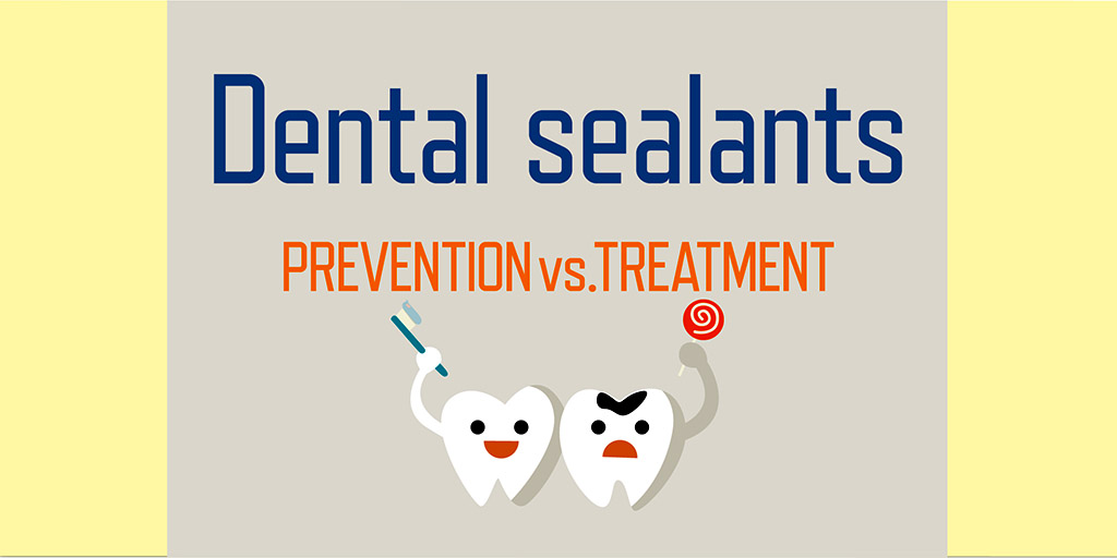 Cartoon figures of teeth. One is happy and the other has a cavity and is upset. Text reads Dental sealants prevention vs treatment
